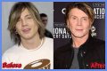 John Rzeznik Facelift | Goo Goo Dolls Frontman Plastic Surgery Before And After